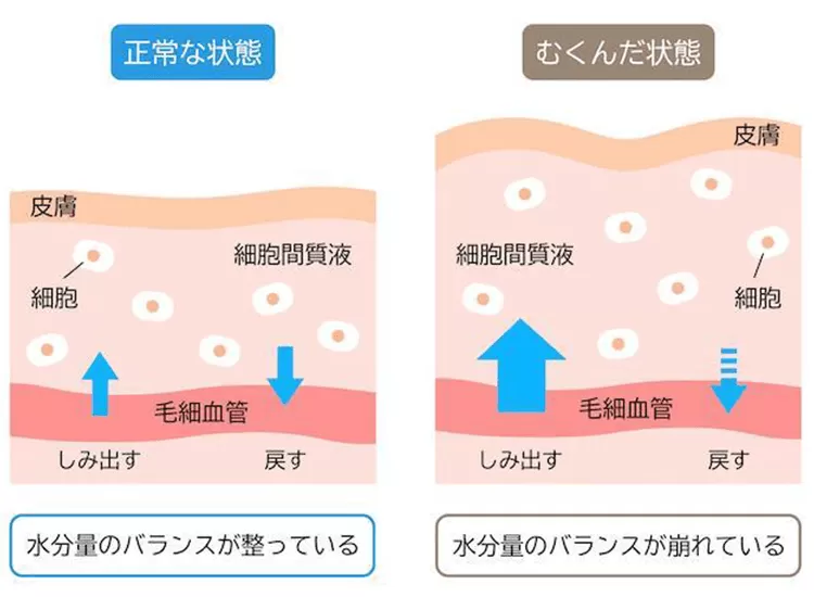 浮腫み　肌断面